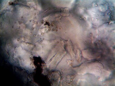 Ev yapımı mikroorganizmaların mikroskobik fotoğrafı