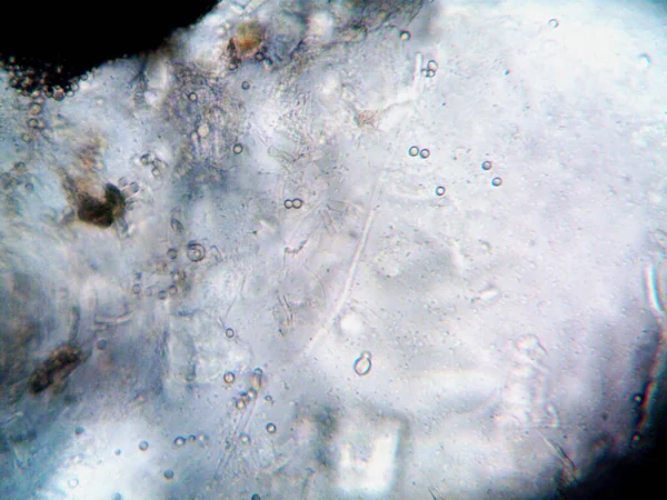 Ev yapımı mikroorganizmaların mikroskobik fotoğrafı