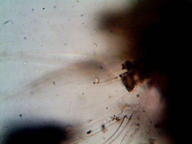 Ev yapımı mikroorganizmaların mikroskobik fotoğrafı