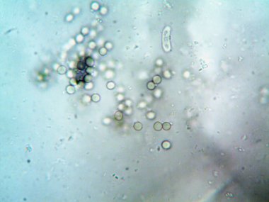 Ev yapımı mikroorganizmaların mikroskobik fotoğrafı