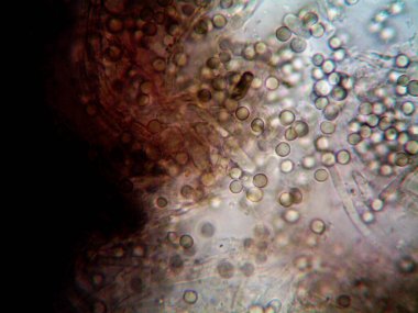 Ev yapımı mikroorganizmaların mikroskobik fotoğrafı