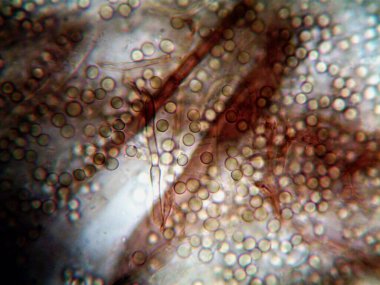 Ev yapımı mikroorganizmaların mikroskobik fotoğrafı