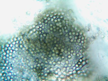 Ev yapımı mikroorganizmaların mikroskobik fotoğrafı