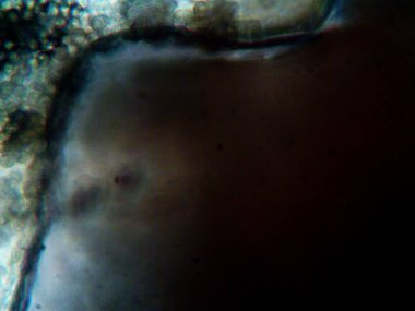 Ev yapımı mikroorganizmaların mikroskobik fotoğrafı