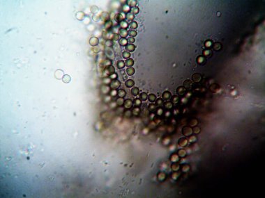 Ev yapımı mikroorganizmaların mikroskobik fotoğrafı