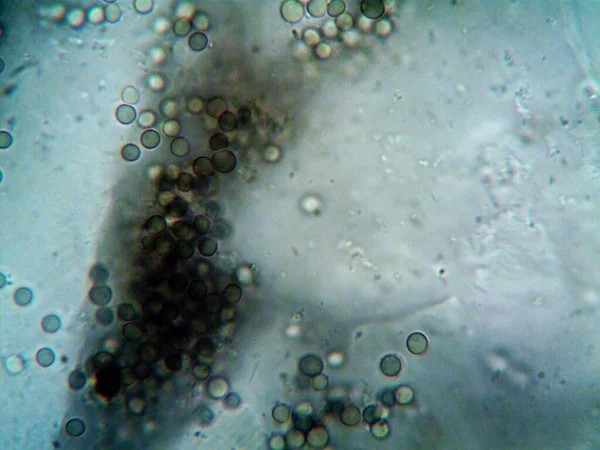 Mikroskopiskt Foto Hemgjorda Mikroorganismer — Stockfoto