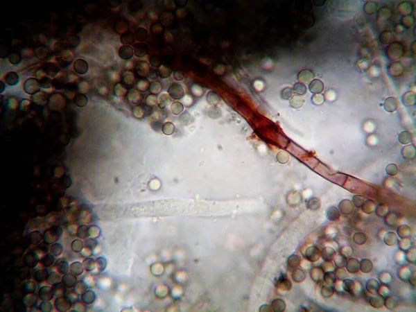 Foto Microscópica Microorganismos Caseiros — Fotografia de Stock