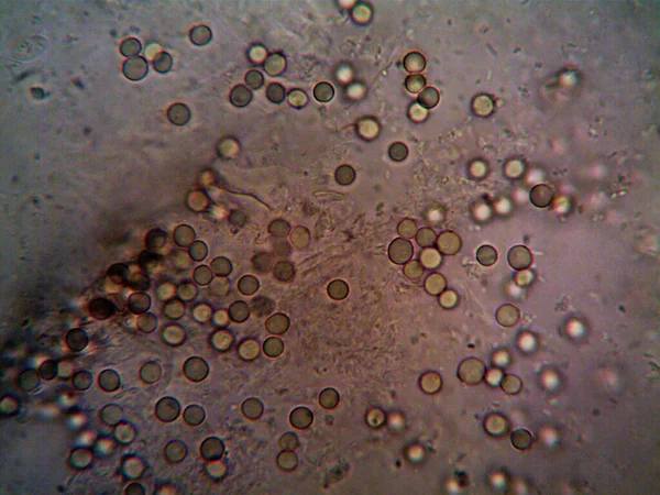 Mikroskopiskt Foto Hemgjorda Mikroorganismer — Stockfoto