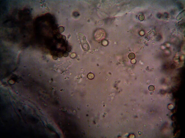 Ev yapımı mikroorganizmaların mikroskobik fotoğrafı