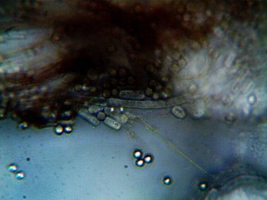 Mikroskopi, benim tarafımdan bulunan orantısızlığın fotoğrafı.