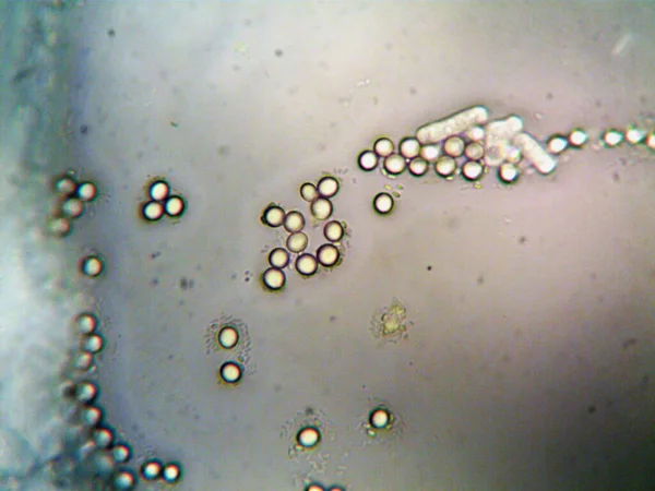 Microscopía Foto Del Oranismo Encontrado Por —  Fotos de Stock