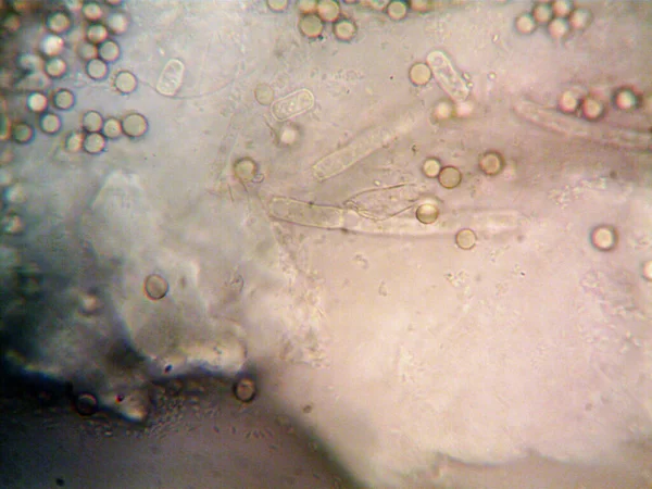 Microscopía Foto Del Oranismo Encontrado Por —  Fotos de Stock