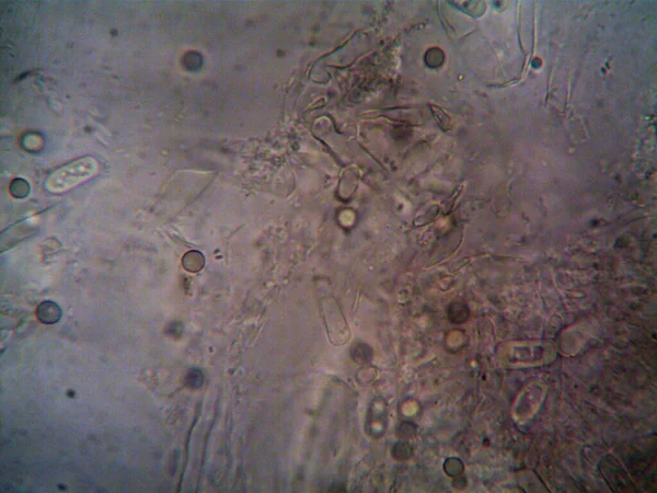 Microscopía Foto Del Oranismo Encontrado Por —  Fotos de Stock