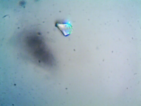 Microscopy Photo Oranism Found — Stock Photo, Image
