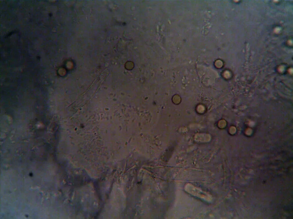 Microscopia Foto Oranismo Encontrado Por Mim — Fotografia de Stock