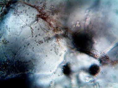 Mikroskopi, benim tarafımdan bulunan orantısızlığın fotoğrafı.