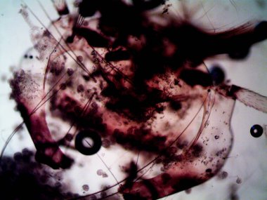 Mikroskopi, benim tarafımdan bulunan orantısızlığın fotoğrafı.