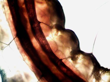 Mikroskopi, benim tarafımdan bulunan orantısızlığın fotoğrafı.