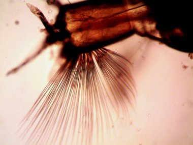 Mikroskopi, benim tarafımdan bulunan orantısızlığın fotoğrafı.