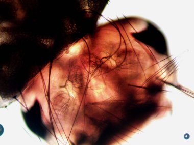 Mikroskopi, benim tarafımdan bulunan orantısızlığın fotoğrafı.