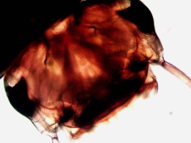 Mikroskopi, benim tarafımdan bulunan orantısızlığın fotoğrafı.