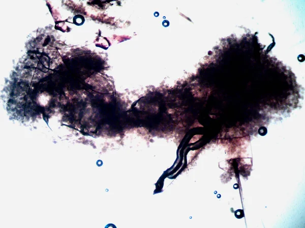 Mikroskopi, benim tarafımdan bulunan orantısızlığın fotoğrafı.