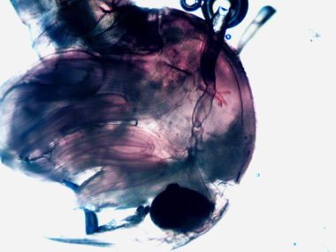 Mikroskopi, benim tarafımdan bulunan orantısızlığın fotoğrafı.