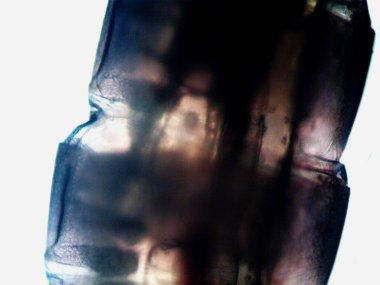 Mikroskopi, benim tarafımdan bulunan orantısızlığın fotoğrafı.