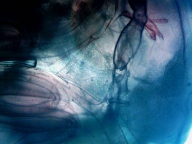 Mikroskopi, benim tarafımdan bulunan orantısızlığın fotoğrafı.