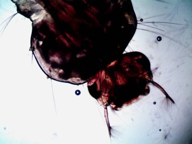 Mikroskopi, benim tarafımdan bulunan orantısızlığın fotoğrafı.