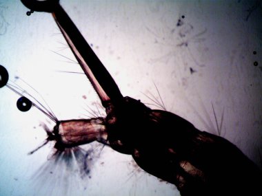 Mikroskopi, benim tarafımdan bulunan orantısızlığın fotoğrafı.