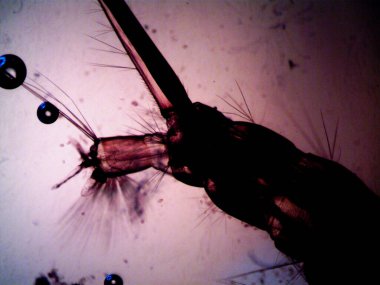 Mikroskopi, benim tarafımdan bulunan orantısızlığın fotoğrafı.