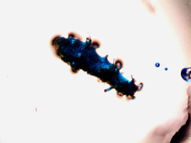 Mikroskopi, benim tarafımdan bulunan orantısızlığın fotoğrafı.