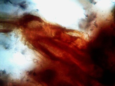 Mikroskopi, benim tarafımdan bulunan orantısızlığın fotoğrafı.