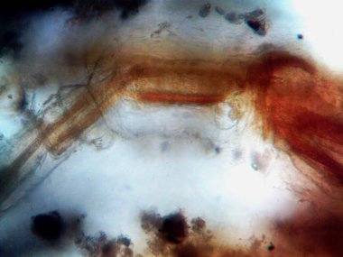 Mikroskopi, benim tarafımdan bulunan orantısızlığın fotoğrafı.