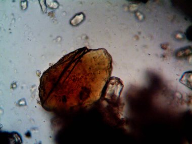 Mikroskopi, benim tarafımdan bulunan orantısızlığın fotoğrafı.