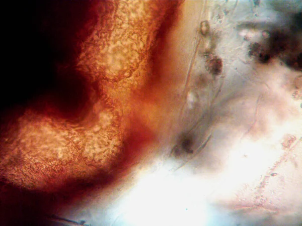 Microscopía Foto Del Oranismo Encontrado Por —  Fotos de Stock