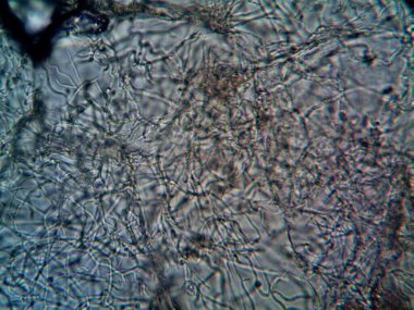 Lavabomun altındaki kirli suda yaşayan mikroorganizma.