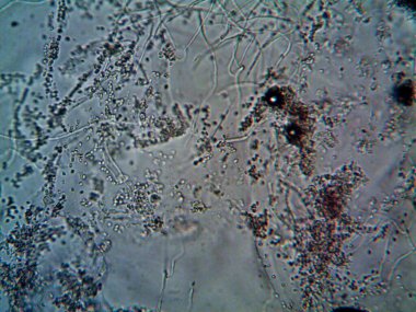 Lavabomun altındaki kirli suda yaşayan mikroorganizma.