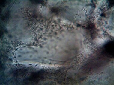 Lavabomun altındaki kirli suda yaşayan mikroorganizma.