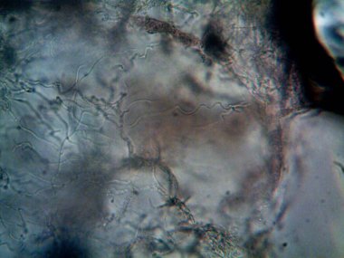 Lavabomun altındaki kirli suda yaşayan mikroorganizma.