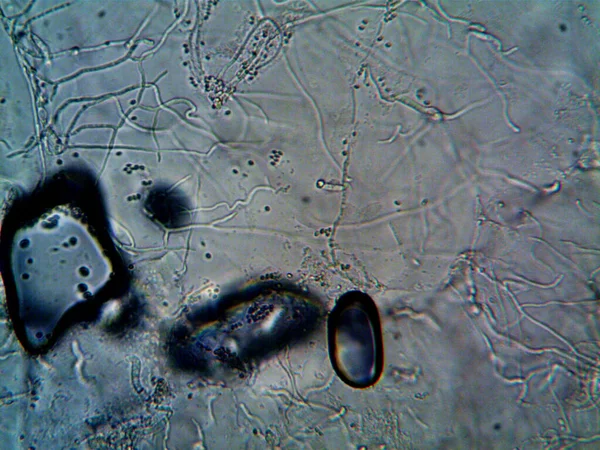 Microorganismo Viviendo Agua Sucia Debajo Fregadero —  Fotos de Stock