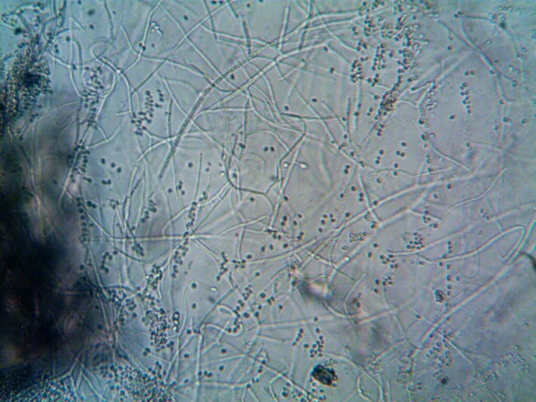 Microscópio Água Suja Todo Organismo Que Encontrei — Fotografia de Stock