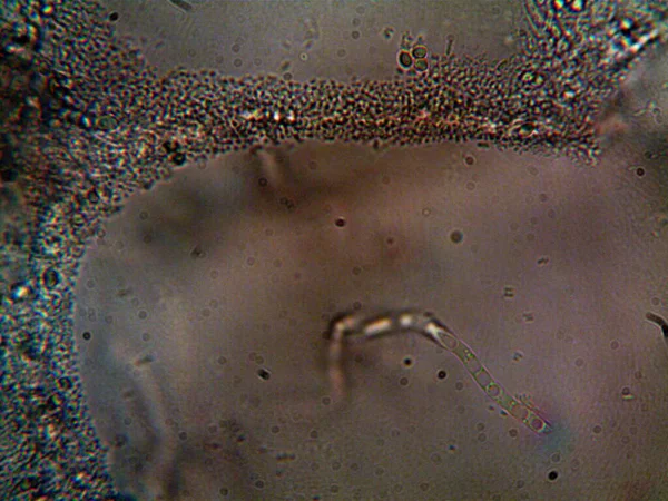 Mikroorganism Som Lever Smutsigt Vatten Diskhon — Stockfoto