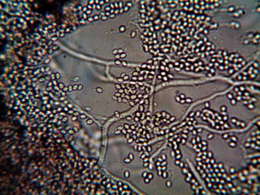 Lavabomun altındaki kirli suda yaşayan mikroorganizma.