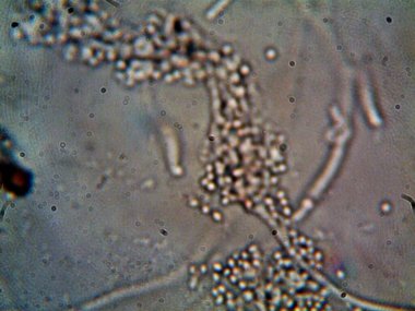 Lavabomun altındaki kirli suda yaşayan mikroorganizma.