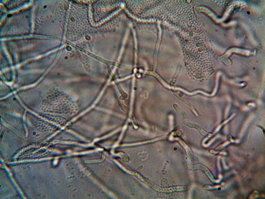 Lavabomun altındaki kirli suda yaşayan mikroorganizma.