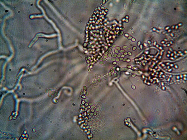 Mikroorganismen Die Schmutzwasser Unter Meiner Spüle Leben — Stockfoto