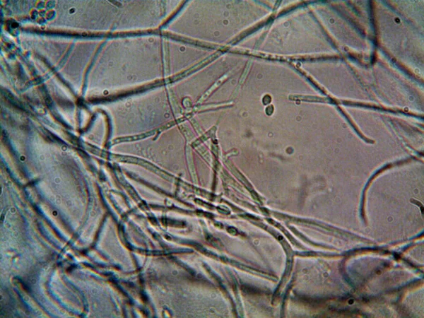 Lavabomun altındaki kirli suda yaşayan mikroorganizma.