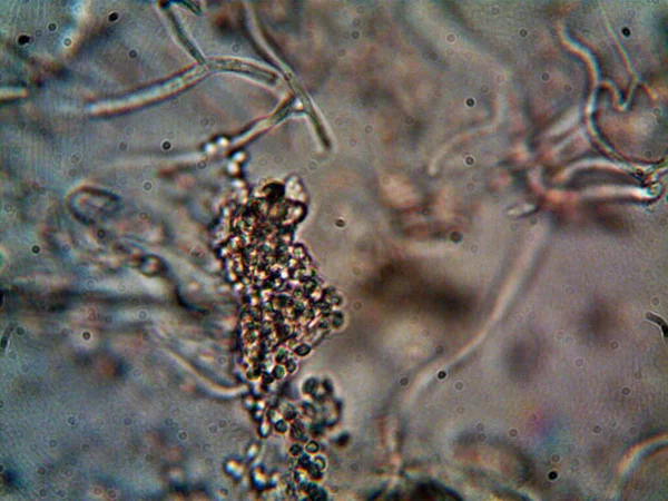 Lavabomun Altındaki Kirli Suda Yaşayan Mikroorganizma — Stok fotoğraf